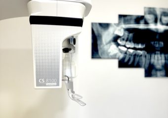 Radiographie panoramique 2D